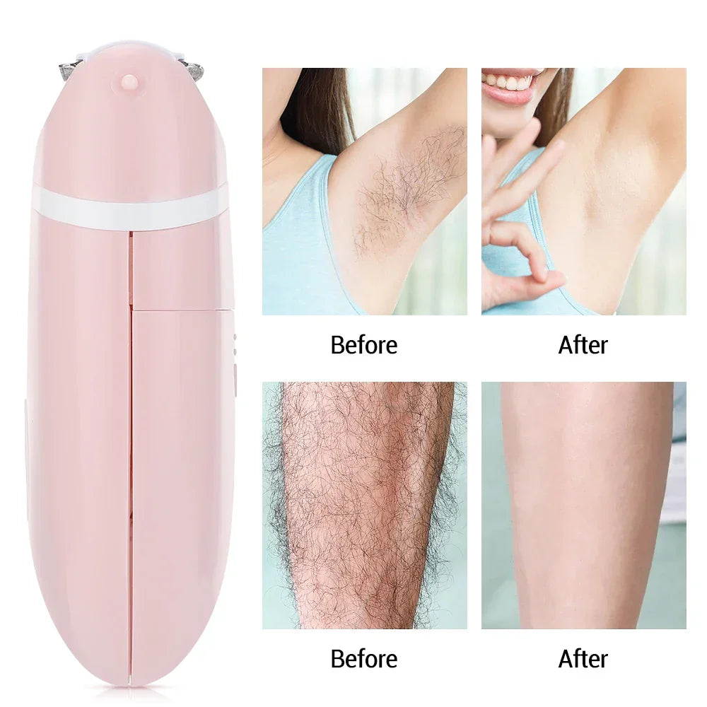 Hair Removal Machine Painless Epilator - Empire P.E