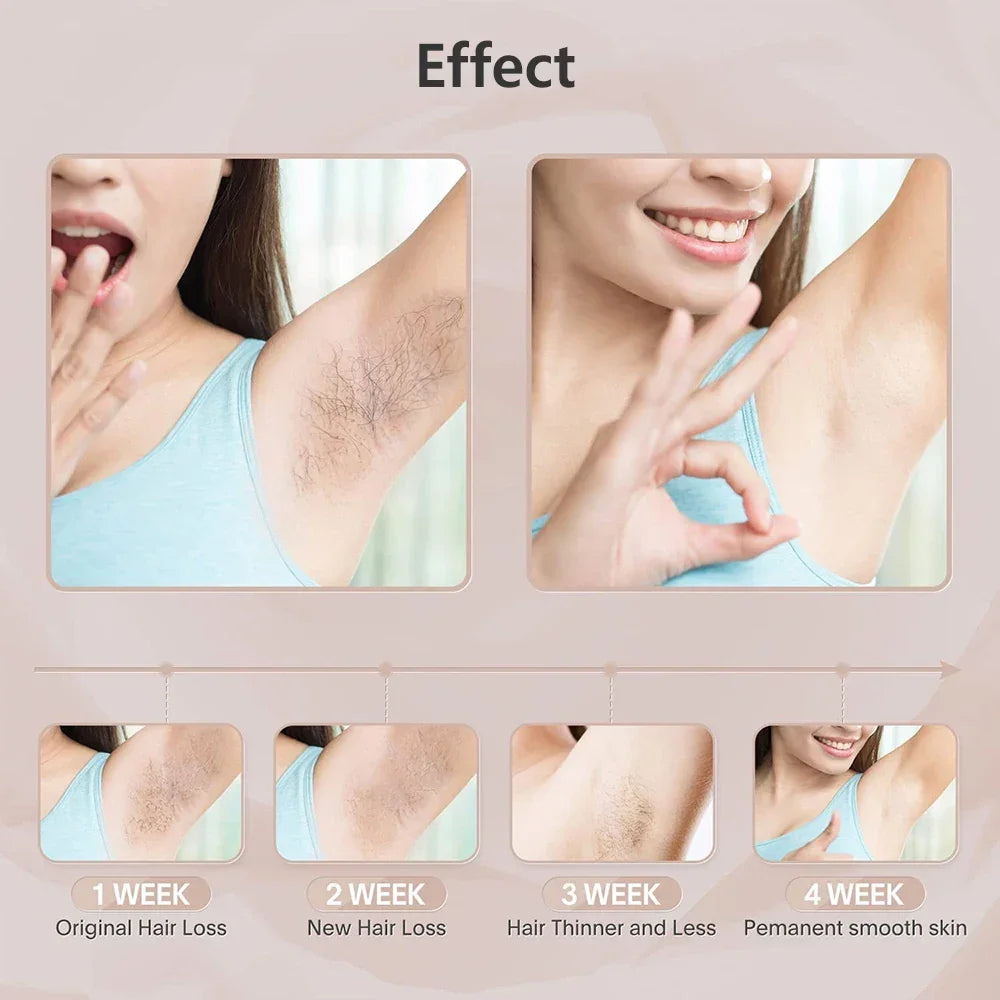 Permanent Laser Epilator Professional Painless Laser Hair Removal - Empire P.E