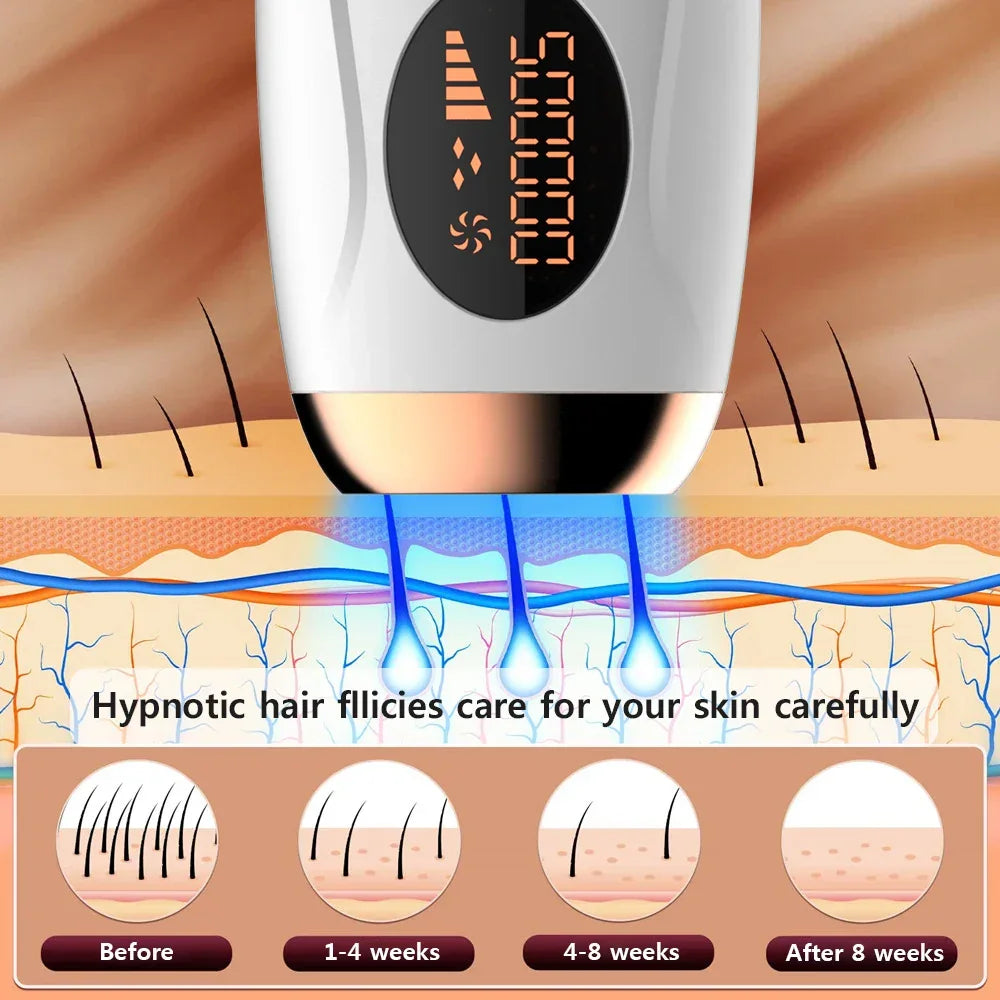 Permanent Laser Epilator Professional Painless Laser Hair Removal - Empire P.E