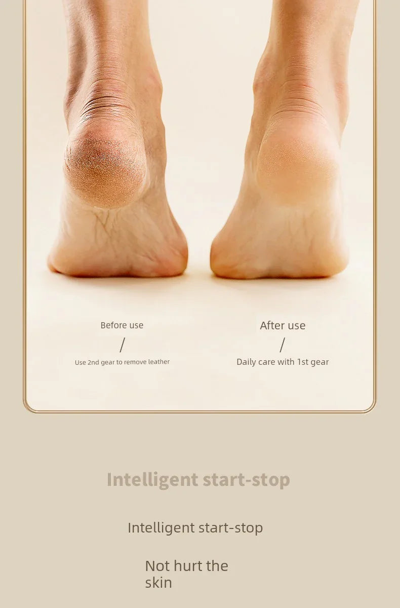 Electric Foot Callus Remover Rechargeable - Empire P.E