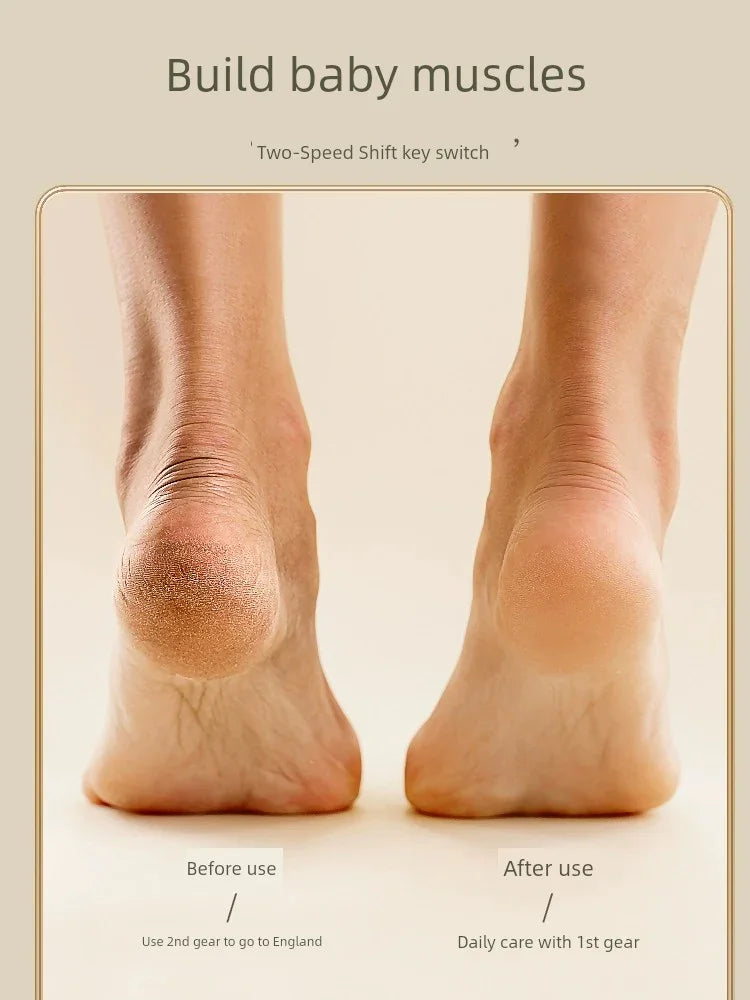 Electric Foot Callus Remover Rechargeable - Empire P.E